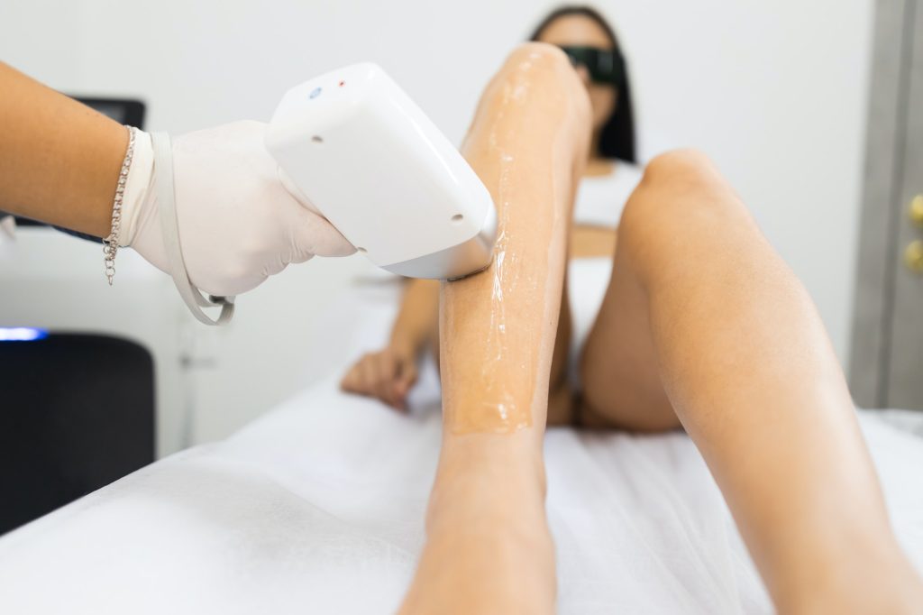 Laser hair removal from woman's legs